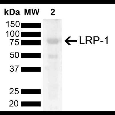 Western Blot: LRP-1 Antibody [NBP2-62752] - Western blot analysis of Rat Kidney showing detection of 504.6 kDa LRP-1 protein using Rabbit Anti-LRP-1 Polyclonal Antibody (NBP2-62752). Lane 1: Molecular Weight Ladder (MW). Lane 2: Rat Kidney. Load: 15 ug. Block: 5% Skim Milk powder in TBST. Primary Antibody: Rabbit Anti-LRP-1 Polyclonal Antibody (NBP2-62752) at 1:1000 for 2 hours at RT with shaking. Secondary Antibody: Goat Anti-Rabbit IgG: HRP at 1:5000 for 1 hour at RT. Color Development: ECL solution for 5 min at RT. Predicted/Observed Size: 504.6 kDa. Other Band(s): 80 kDa, 50 kDa.